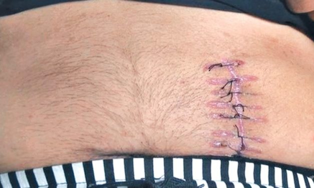 Washington Post — Organ traffickers lock up people to harvest their kidneys. Here are the politics behind the organ trade